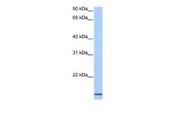 Cyclin L2 Rabbit anti-Human, Polyclonal, Novus Biologicals 0.1 mL | Buy Online | Novus Biologicals | Fisher Scientific